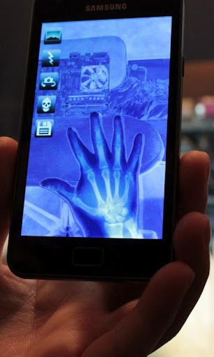 XRay Camera - صورة شاشة 1
